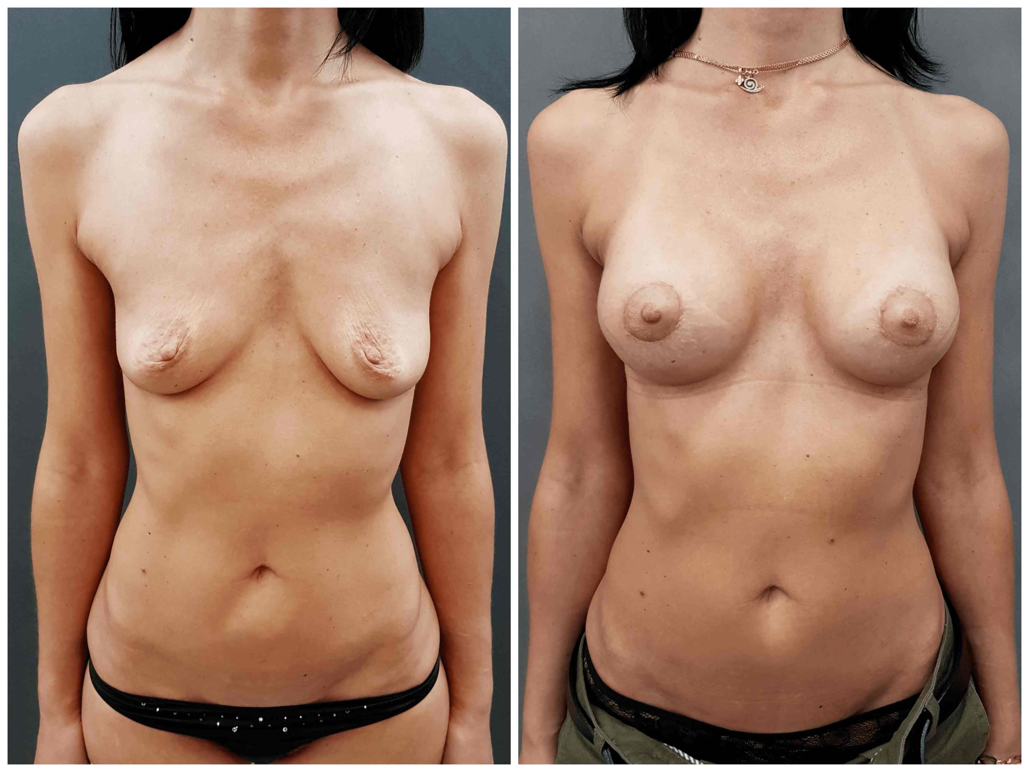 увеличивается грудь у женщин фото 54